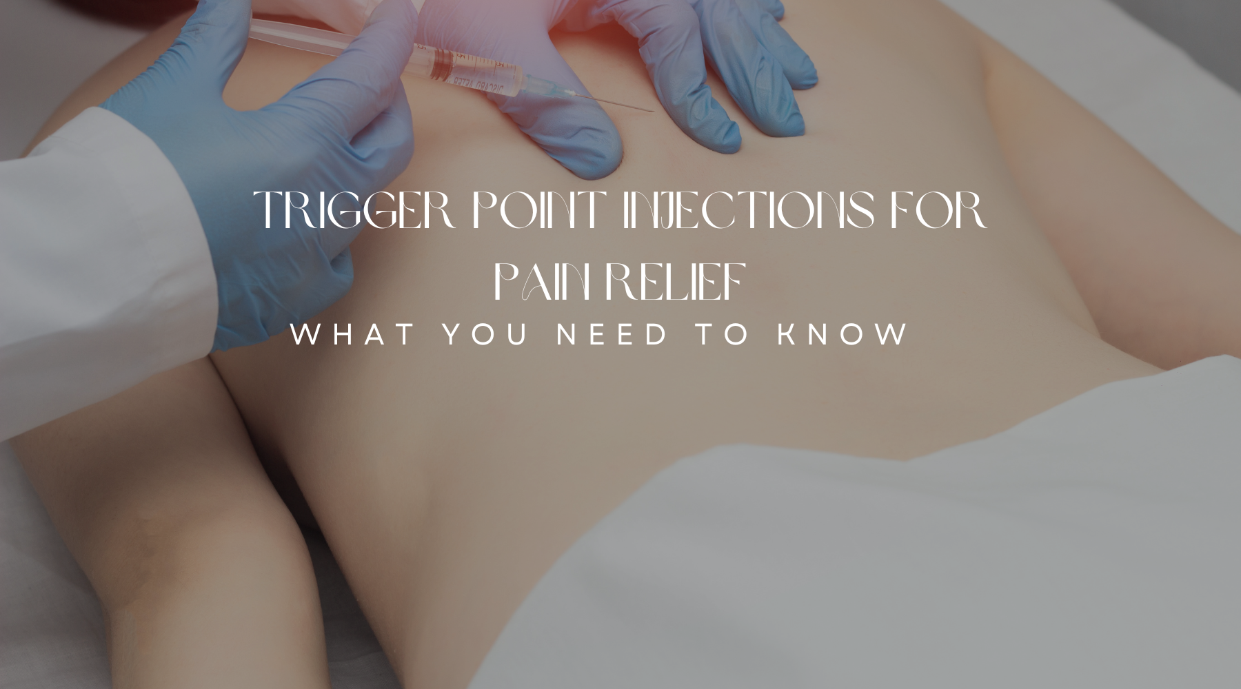 Trigger Point Injections for Pain Relief: What You Need to Know