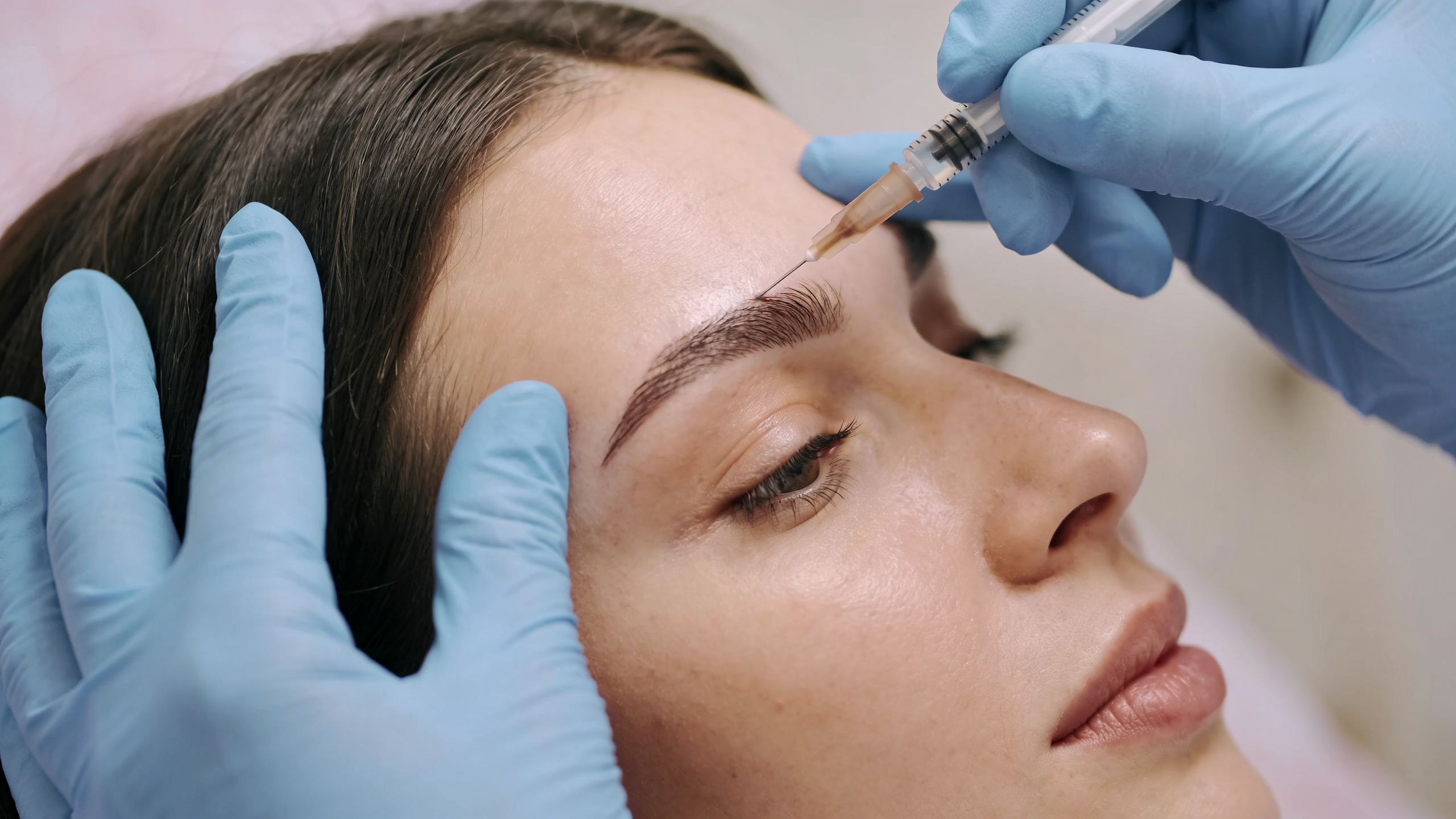 Dermal Filler Between Eyebrows: Expert 2026 Guide