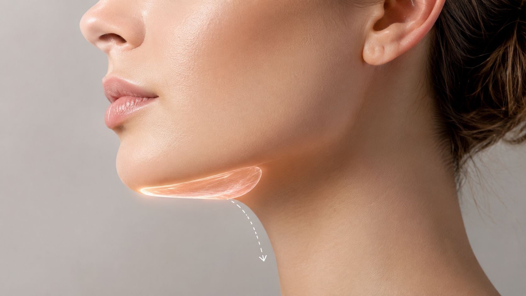 Do Chin Fillers Migrate? Signs, Causes, and Prevention