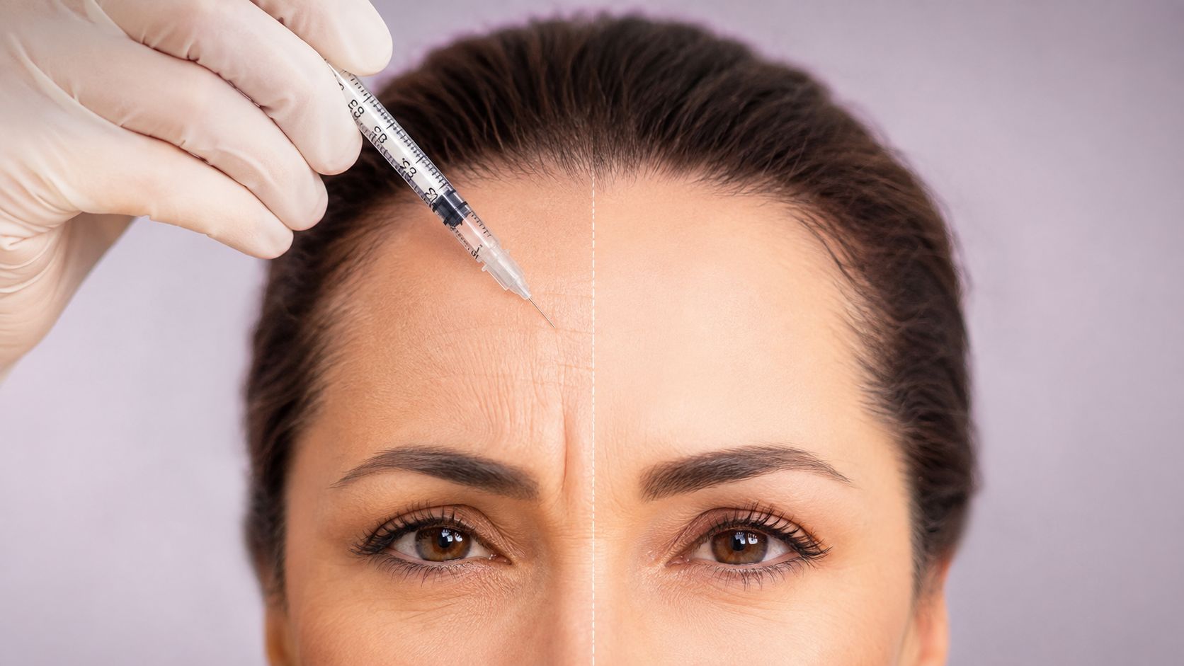 Dysport for Frown Lines: What to Know Before You Book