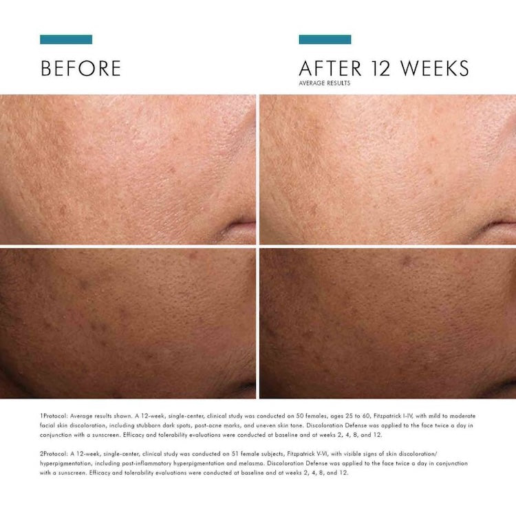 SkinCeuticals Discoloration Defense - BotoxBarb