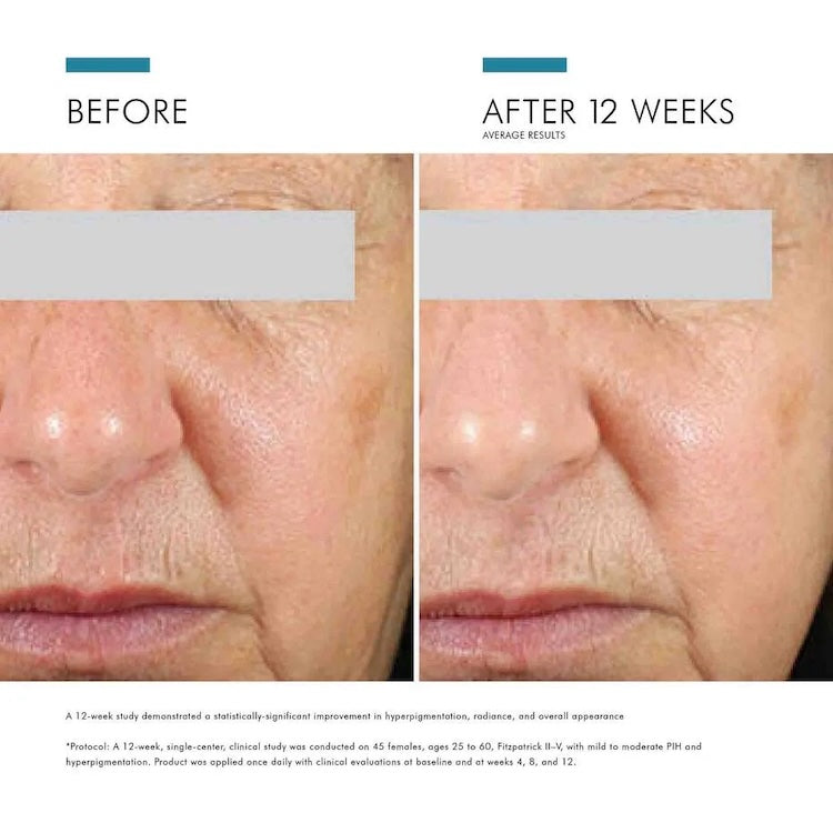 SkinCeuticals Daily Brightening UV Defense Sunscreen SPF 30 - BotoxBarb