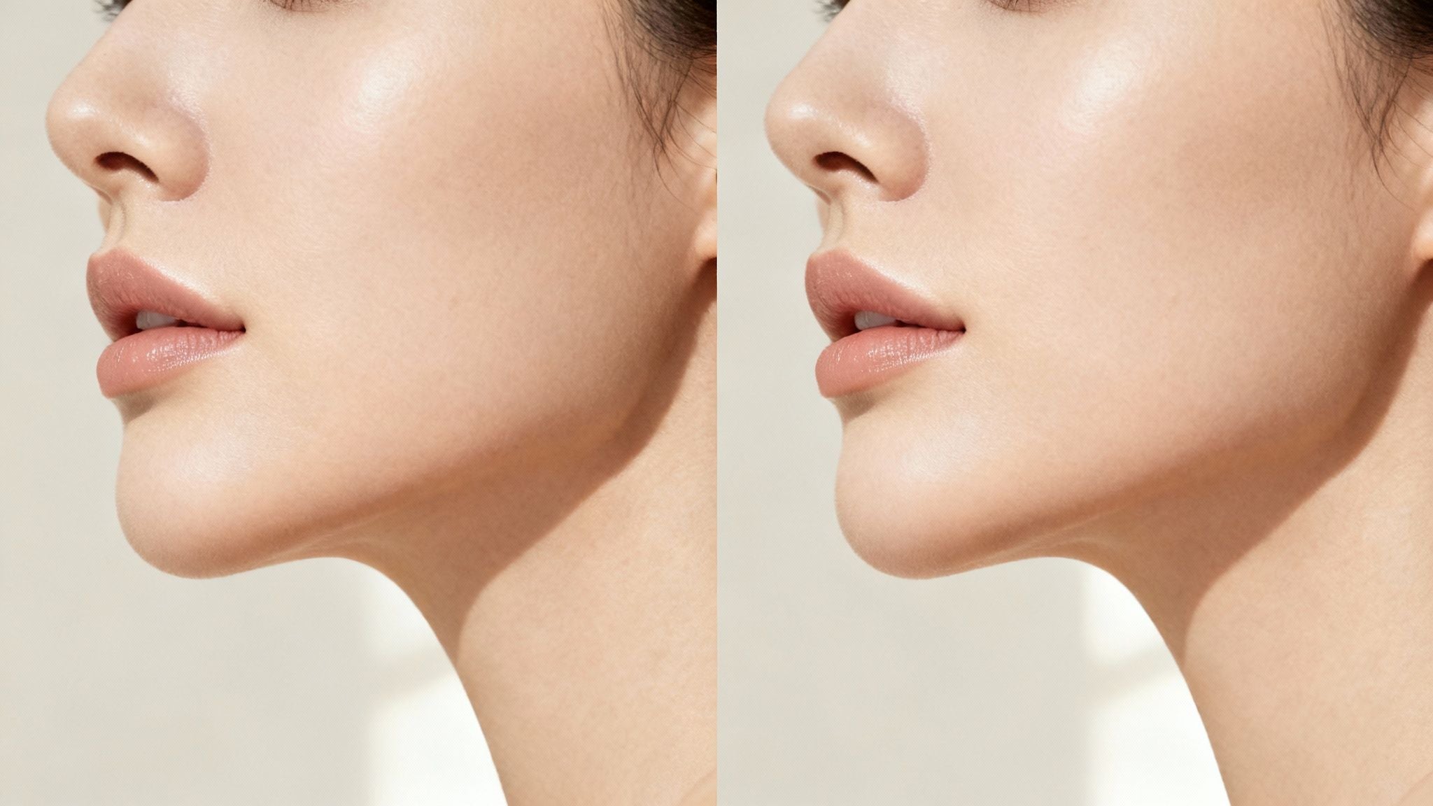 Chin Filler Before and After A Guide to Natural-Looking Results
