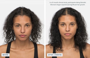 Nutrafol Women’s Vegan - Growth Pack (3 month supply) - BotoxBarb 