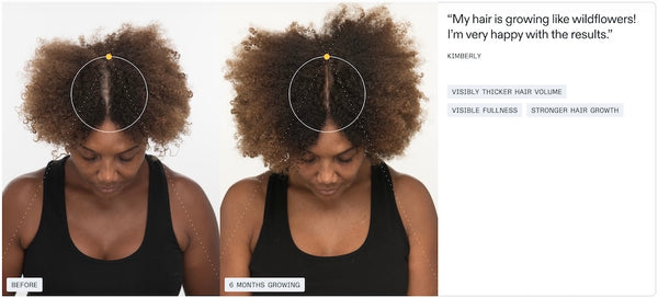 Nutrafol Women’s Balance - Growth Pack (3 month supply) - BotoxBarb 