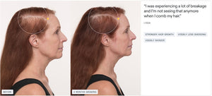 Nutrafol Women’s Balance - Growth Pack (3 month supply) - BotoxBarb 