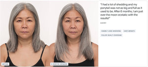 Nutrafol Women’s Balance - Growth Pack (3 month supply) - BotoxBarb 