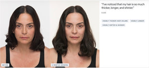 Nutrafol Women’s Balance - Growth Pack (3 month supply) - BotoxBarb 