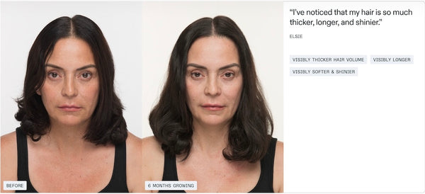 Nutrafol Women’s Balance - Growth Pack (3 month supply) - BotoxBarb 