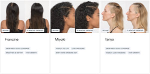 Nutrafol Women’s Vegan - Growth Pack (3 month supply) - BotoxBarb 