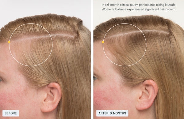 Nutrafol Women’s Balance - Growth Pack (3 month supply) - BotoxBarb 