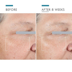 SkinCeuticals A.G.E. Advanced Eye for Dark Circles - BotoxBarb 