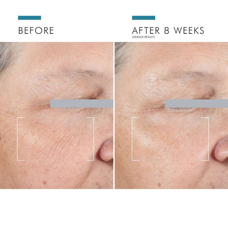 SkinCeuticals A.G.E. Advanced Eye for Dark Circles - BotoxBarb 