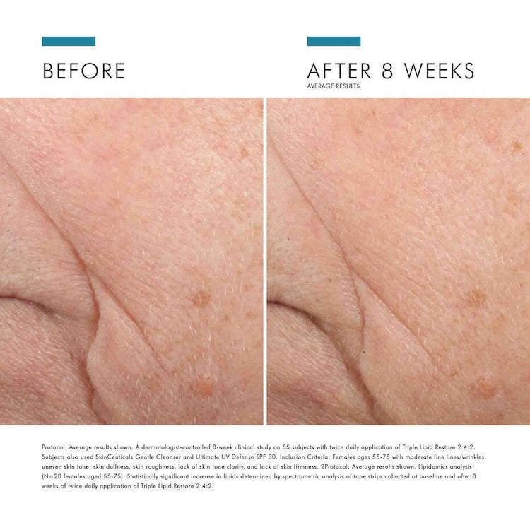 SkinCeuticals Triple Lipid Restore 2:4:2 - BotoxBarb 