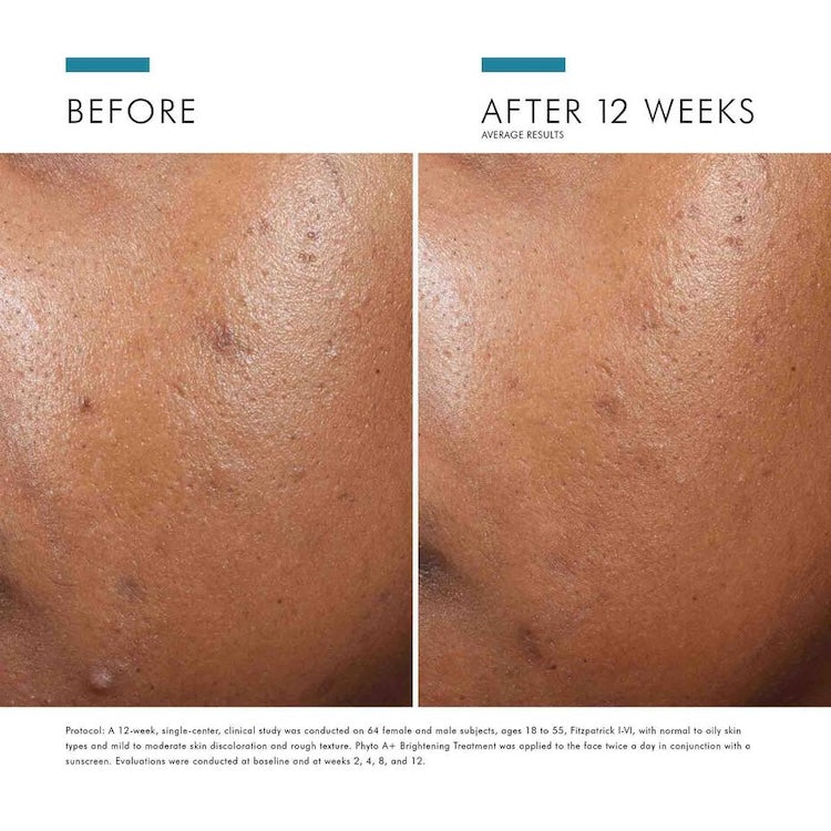 SkinCeuticals Phyto A+ Brightening Treatment - BotoxBarb 