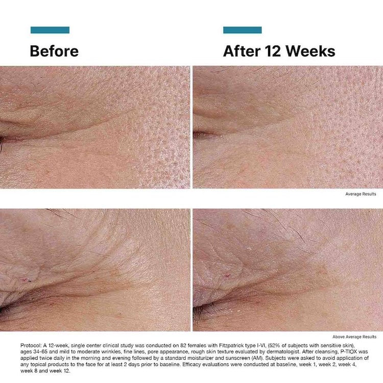 SkinCeuticals P-TIOX - BotoxBarb 